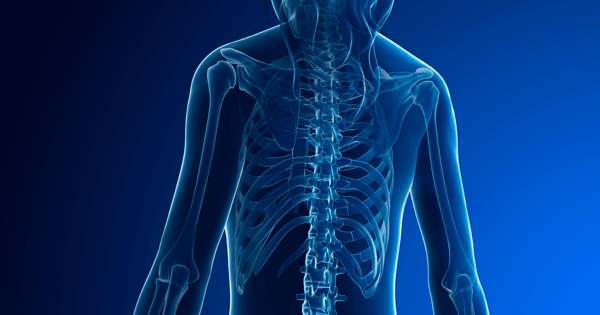 Musculoskeletal Disorders - What can employers do