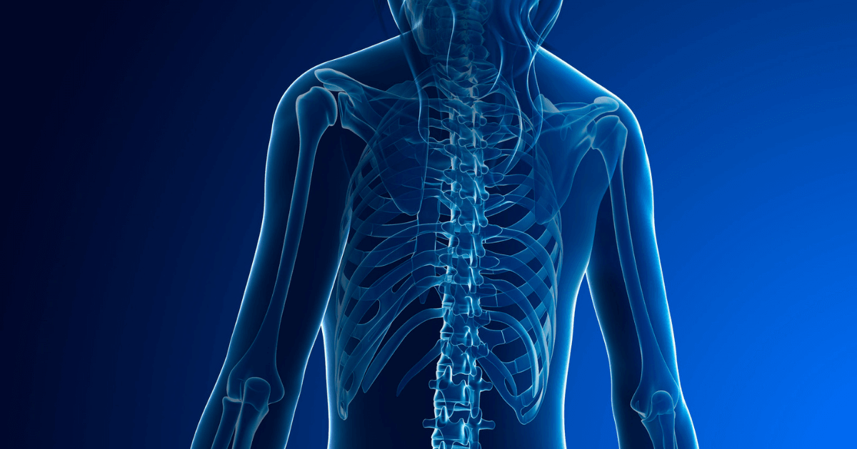 Musculoskeletal20Disorders20-20What20can20employers20do-1
